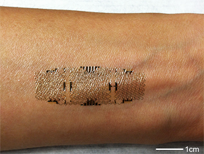 arm with band-aid shaped skin graph